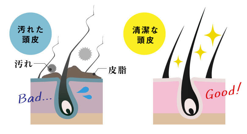 タングルティーザー